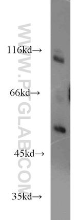 RIPK2 Antibody in Western Blot (WB)