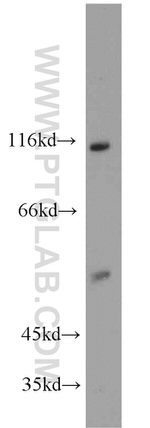 RIPK2 Antibody in Western Blot (WB)