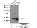 RBM17 Antibody in Immunoprecipitation (IP)