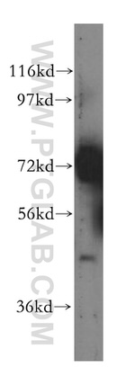 RBM17 Antibody in Western Blot (WB)