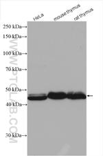 RBM17 Antibody in Western Blot (WB)