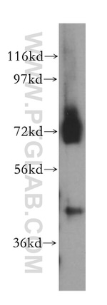 RBM17 Antibody in Western Blot (WB)