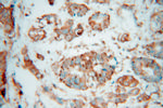 SPTLC1 Antibody in Immunohistochemistry (Paraffin) (IHC (P))