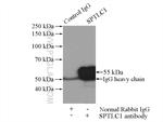 SPTLC1 Antibody in Immunoprecipitation (IP)