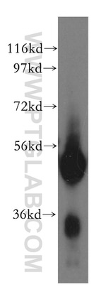 SPTLC1 Antibody in Western Blot (WB)