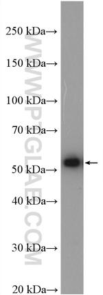 SPTLC1 Antibody in Western Blot (WB)