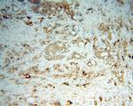 CES2 Antibody in Immunohistochemistry (Paraffin) (IHC (P))