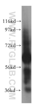 CES2 Antibody in Western Blot (WB)