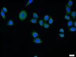 SURF1 Antibody in Immunocytochemistry (ICC/IF)