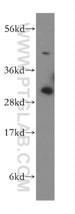 SURF1 Antibody in Western Blot (WB)