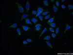 CEL Antibody in Immunocytochemistry (ICC/IF)