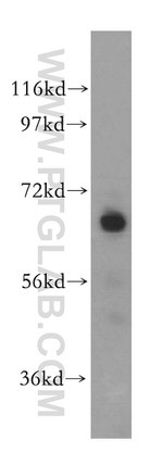 CEL Antibody in Western Blot (WB)