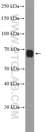 CEL Antibody in Western Blot (WB)