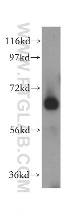 CEL Antibody in Western Blot (WB)