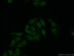 RPL6 Antibody in Immunocytochemistry (ICC/IF)