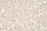 RPL6 Antibody in Immunohistochemistry (Paraffin) (IHC (P))