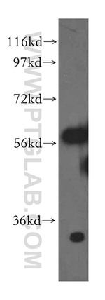 RPL6 Antibody in Western Blot (WB)