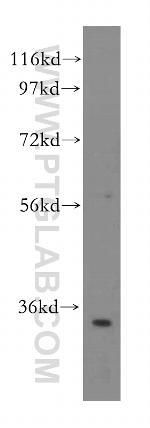 RPL6 Antibody in Western Blot (WB)