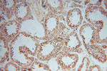 GNB3 Antibody in Immunohistochemistry (Paraffin) (IHC (P))