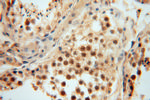 GNB3 Antibody in Immunohistochemistry (Paraffin) (IHC (P))