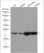 GNB3 Antibody in Western Blot (WB)