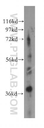 GNB3 Antibody in Western Blot (WB)