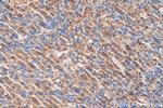 BRCC3 Antibody in Immunohistochemistry (Paraffin) (IHC (P))