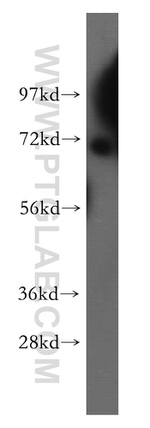 BRCC3 Antibody in Western Blot (WB)