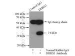 DHRS3 Antibody in Immunoprecipitation (IP)