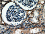 PRMT6 Antibody in Immunohistochemistry (Paraffin) (IHC (P))