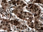 PRMT6 Antibody in Immunohistochemistry (Paraffin) (IHC (P))