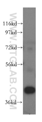 PRMT6 Antibody in Western Blot (WB)