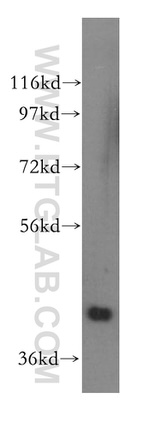 PRMT6 Antibody in Western Blot (WB)