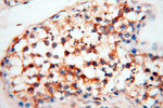 SEC13 Antibody in Immunohistochemistry (Paraffin) (IHC (P))