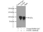 SATB1 Antibody in Immunoprecipitation (IP)