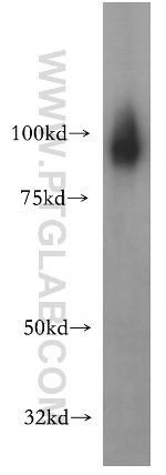 SATB1 Antibody in Western Blot (WB)