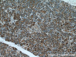 NUBP2 Antibody in Immunohistochemistry (Paraffin) (IHC (P))