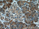 NUBP2 Antibody in Immunohistochemistry (Paraffin) (IHC (P))