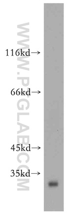 NUBP2 Antibody in Western Blot (WB)