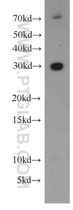 NUBP2 Antibody in Western Blot (WB)