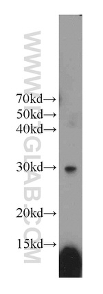 NUBP2 Antibody in Western Blot (WB)