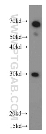 NUBP2 Antibody in Western Blot (WB)