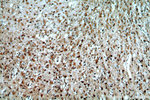 SYT17 Antibody in Immunohistochemistry (Paraffin) (IHC (P))