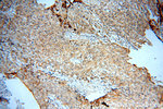 SYT17 Antibody in Immunohistochemistry (Paraffin) (IHC (P))