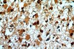 SYT17 Antibody in Immunohistochemistry (Paraffin) (IHC (P))