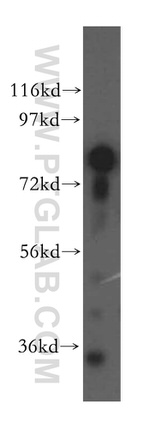 SYT17 Antibody in Western Blot (WB)