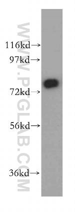 SYT17 Antibody in Western Blot (WB)