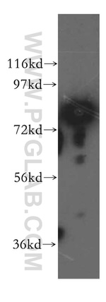 SYT17 Antibody in Western Blot (WB)