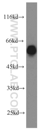 PRPF19 Antibody in Western Blot (WB)