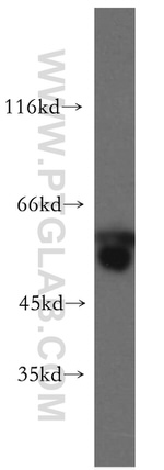 PRPF19 Antibody in Western Blot (WB)